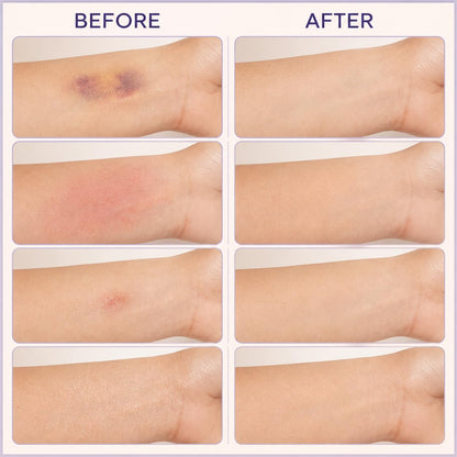NACIDRA Bruise Defense & Repair Serum
